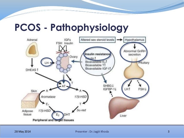 Pcos это. PCOS.