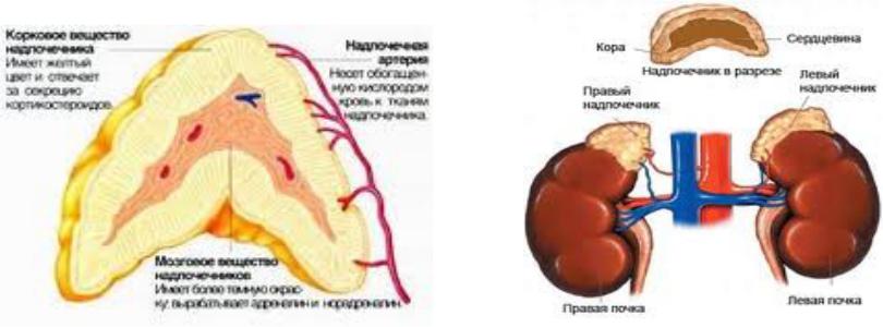 Гиперплазия правого надпочечника